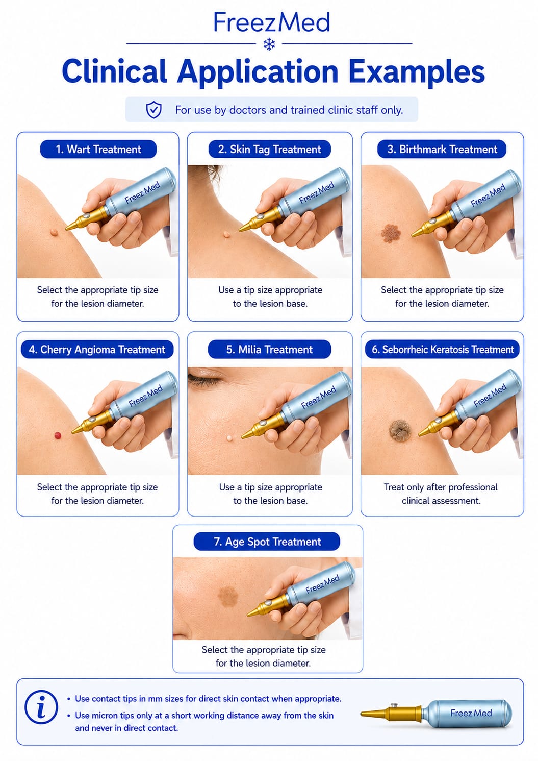 FreezMed clinical application examples for common lesion types